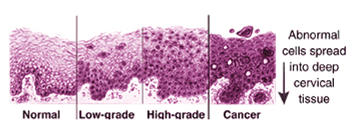 Histological Changes from Healthy to Cancer